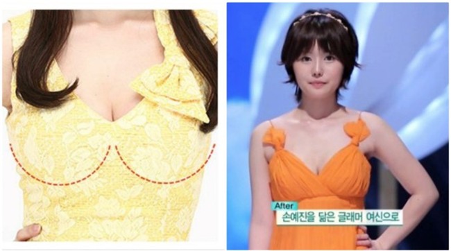 Từng bị dè bỉu vì vẻ ngoài xấu xí, cuộc đời của những người này đã hoàn toàn thay đổi nhờ phẫu thuật thẩm mỹ - Ảnh 12.