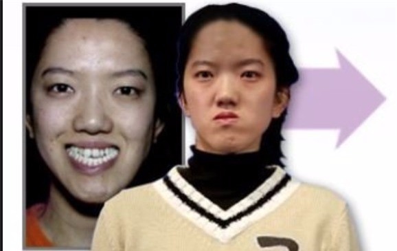 Từng bị dè bỉu vì vẻ ngoài xấu xí, cuộc đời của những người này đã hoàn toàn thay đổi nhờ phẫu thuật thẩm mỹ - Ảnh 15.