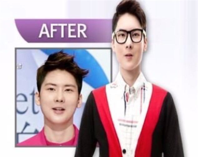 Từng bị dè bỉu vì vẻ ngoài xấu xí, cuộc đời của những người này đã hoàn toàn thay đổi nhờ phẫu thuật thẩm mỹ - Ảnh 8.