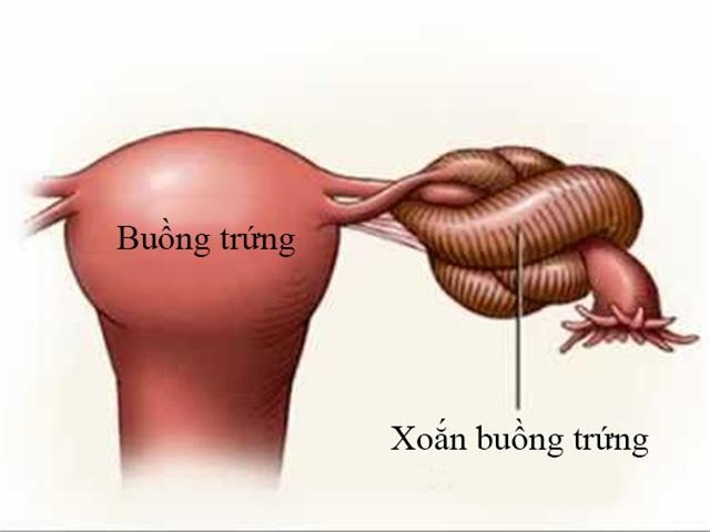 xoan buong trung benh phu khoa anh huong den sinh san cua phu nu - 1