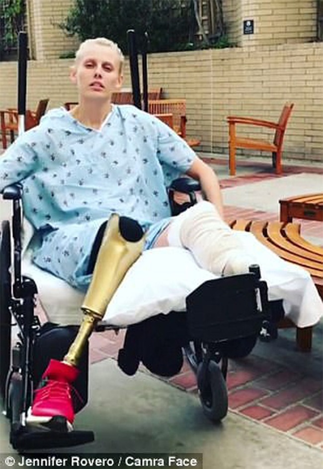 Sử dụng băng vệ sinh sai cách, người phụ nữ suýt nữa mất mạng, phải cắt bỏ cả 2 chân vì đau đớn - Ảnh 2.