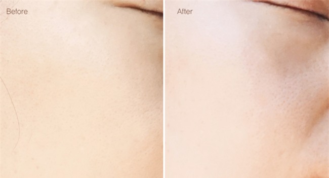 5 sản phẩm tẩy da chết hoá học đang hot tại Hàn, sản phẩm thứ 2 cực hay vì chia theo từng loại da - Ảnh 13.