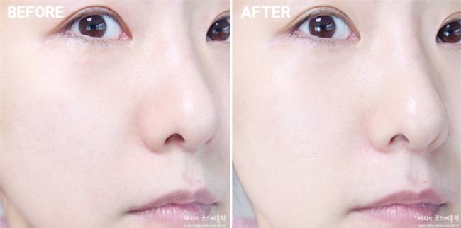 5 sản phẩm tẩy da chết hoá học đang hot tại Hàn, sản phẩm thứ 2 cực hay vì chia theo từng loại da - Ảnh 21.