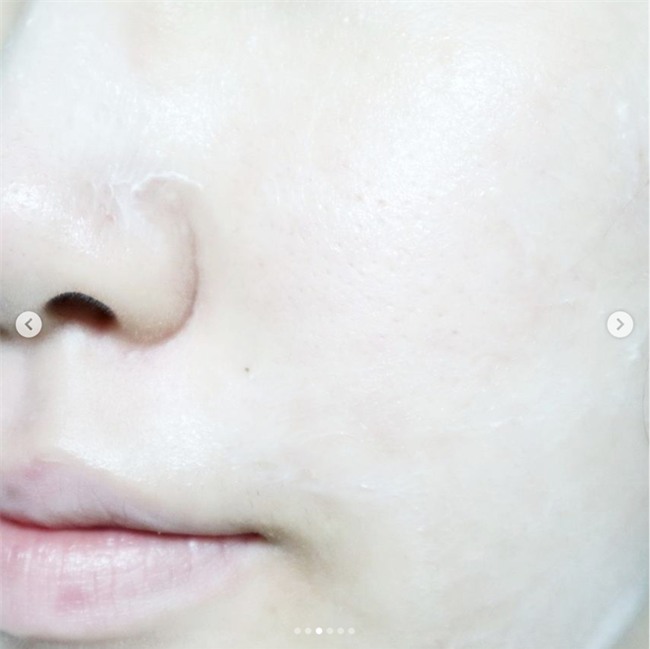 5 sản phẩm tẩy da chết hoá học đang hot tại Hàn, sản phẩm thứ 2 cực hay vì chia theo từng loại da - Ảnh 4.