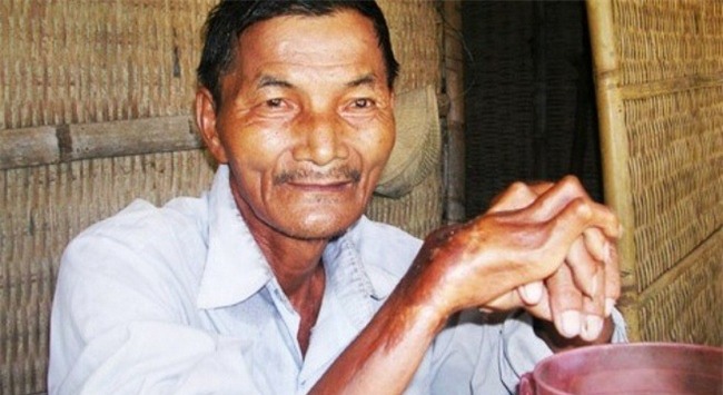 10 dị nhân đời thực với năng lực siêu nhiên chẳng khác nào X-Men trong truyền thuyết-4