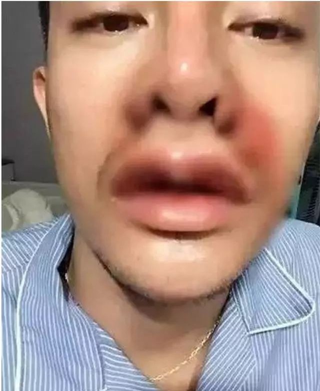 Sửa mặt thành nghiện, Lệ Rơi phiên bản Thái Lan chi bộn tiền, phẫu thuật 30 lần để giống soái ca Hàn Quốc - Ảnh 2.