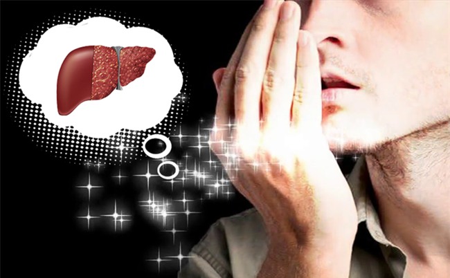 Dấu hiệu cảnh báo gan đang dư thừa chất độc khi thấy mùi này-1
