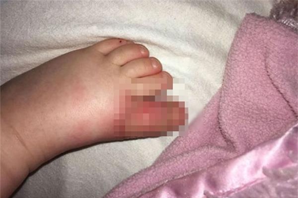 be gai bi bien dang chan vi thoi quen tan dung giay dep cu cua me - 1