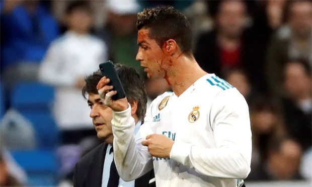 C.Ronaldo dùng điện thoại kiểm tra vết thương