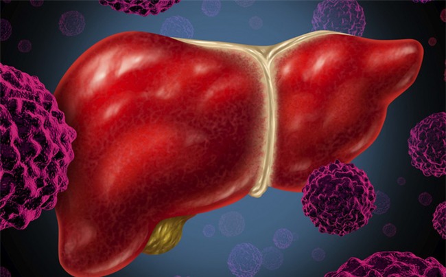 Những nhóm người dễ mắc ung thư gan hơn người khác: Hãy đề phòng!-2