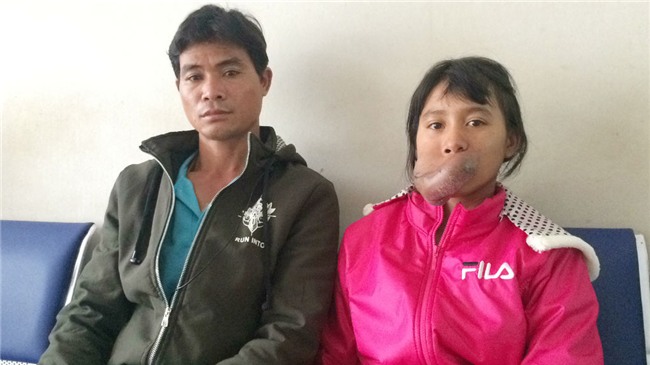 khối u,u máu,bệnh viện Chợ Rẫy,hiếm gặp,bệnh hiếm