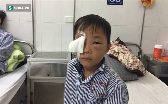 Bé trai 8 tuổi bị chó cắn thủng mắt, bố mẹ nhìn thấy nhưng không kịp trở tay