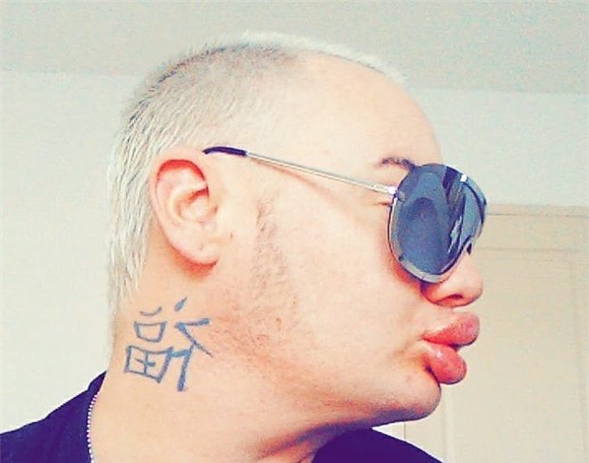 Nghiện phẫu thuật thẩm mỹ, anh chàng bơm môi căng phồng tới hơn 20 lần để nhìn giống... Marilyn Monroe - Ảnh 2.