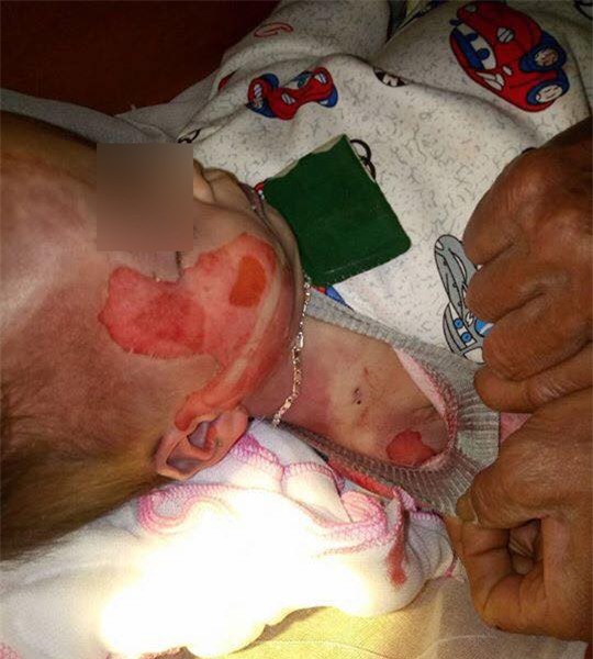 Bé trai tử vong trên người có nhiều vết thương lạ sau khi cấp cứu tại bệnh viện? - Ảnh 1.