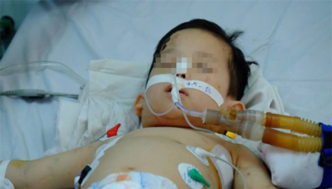 Bác sĩ Thanh Hồng: Kinh hoàng vì quá nhiều bệnh nhi bị chó cắn-1