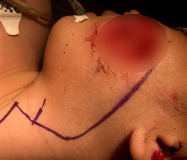 Bác sĩ Thanh Hồng: Kinh hoàng vì quá nhiều bệnh nhi bị chó cắn-2