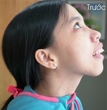 Hành trình kiếm tìm sắc đẹp của cô gái sống thiếu tình thương cha mẹ-1