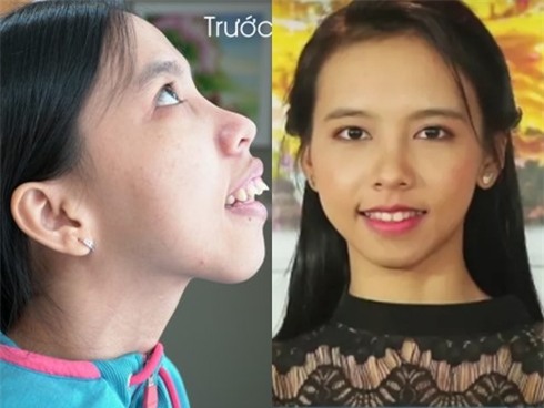 Hành trình kiếm tìm sắc đẹp của cô gái sống thiếu tình thương cha mẹ-2