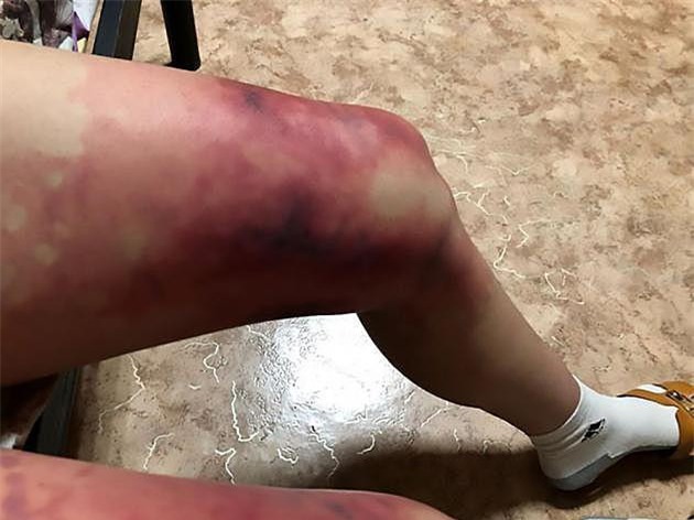 Thời trang “phang” thời tiết, cô gái diện váy ngắn giữa trời đông giá rét và nhận cái kết không thể nào đắng hơn - Ảnh 1.