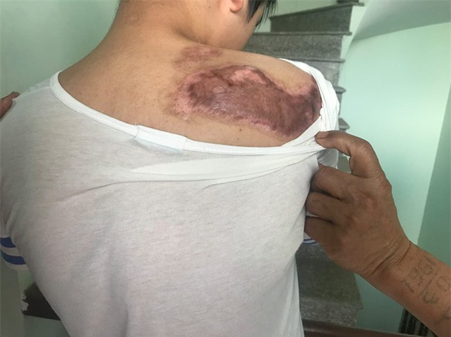 Cậu bé 16 tuổi sống sót sau vụ cháy xưởng bánh kẹo khiến 8 người tử vong ở Hà Nội bây giờ ra sao - Ảnh 2.