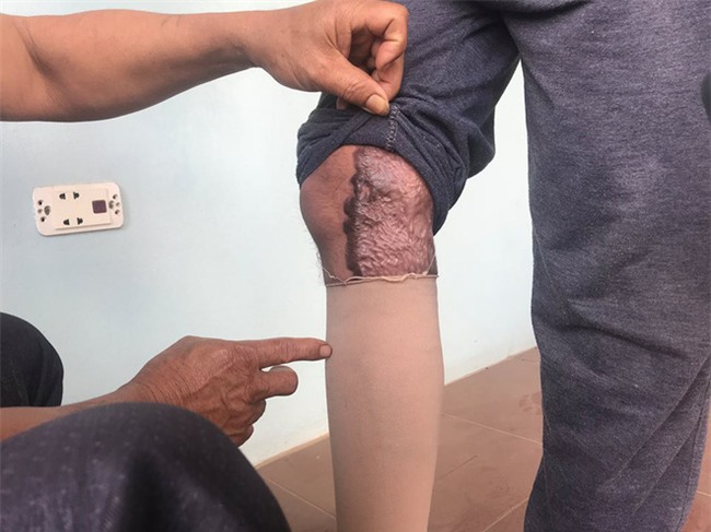 Cậu bé 16 tuổi sống sót sau vụ cháy xưởng bánh kẹo khiến 8 người tử vong ở Hà Nội bây giờ ra sao - Ảnh 3.