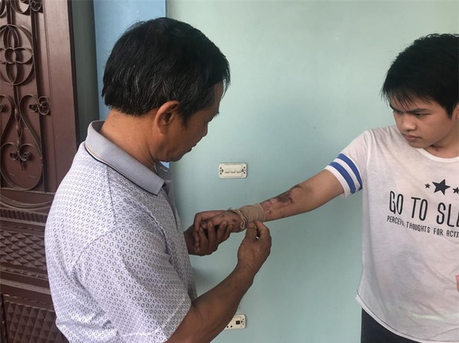 Cậu bé 16 tuổi sống sót sau vụ cháy xưởng bánh kẹo khiến 8 người tử vong ở Hà Nội bây giờ ra sao - Ảnh 5.