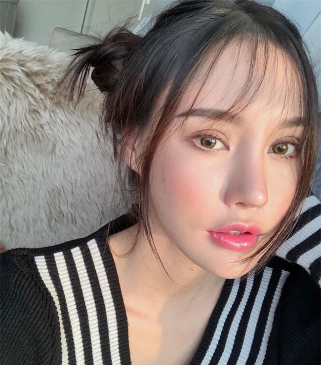 Hot Facebooker Thái Lan "bật mí" quá trình phẫu thuật thẩm mỹ đau đớn nhưng trả về kết quả đẹp xuất sắc - Ảnh 6.