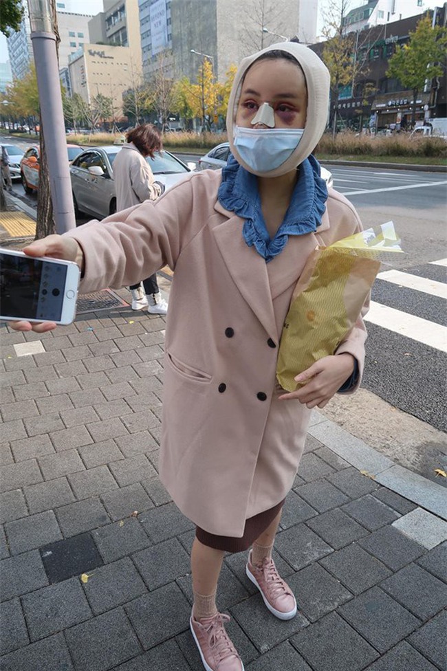 Hot Facebooker Thái Lan "bật mí" quá trình phẫu thuật thẩm mỹ đau đớn nhưng trả về kết quả đẹp xuất sắc - Ảnh 7.