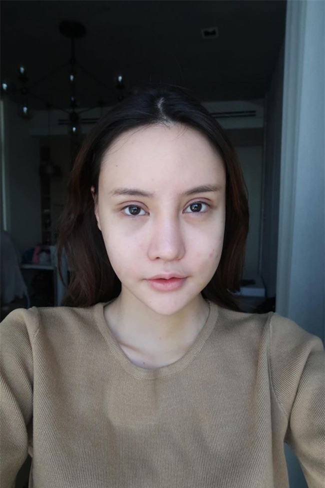 Hot Facebooker Thái Lan "bật mí" quá trình phẫu thuật thẩm mỹ đau đớn nhưng trả về kết quả đẹp xuất sắc - Ảnh 4.