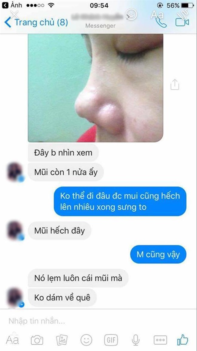 bo 25 trieu lam mui va bi hong, co gai phai chiu 9 lan khau lai khong thuoc te! - 7