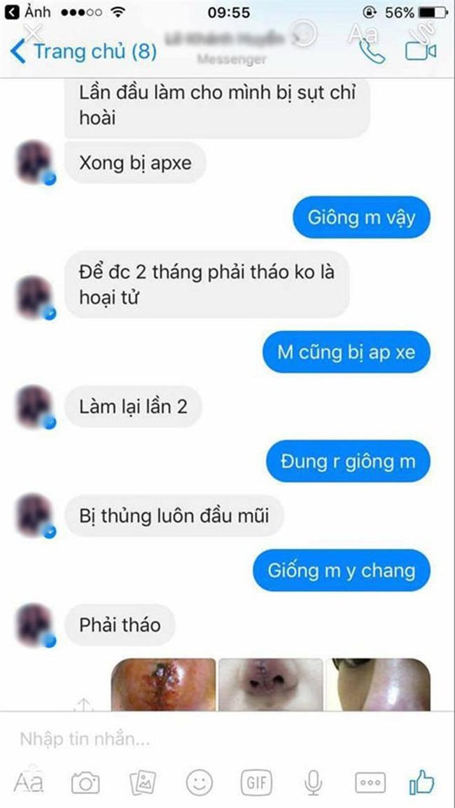 bo 25 trieu lam mui va bi hong, co gai phai chiu 9 lan khau lai khong thuoc te! - 8