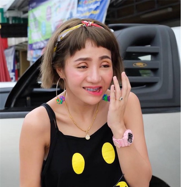 Những pha thẩm mỹ cắt mí thảm nhất 2017-5