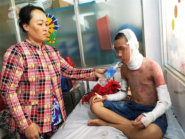 Nước mắt người mẹ bỏ việc lên Sài Gòn chăm con bị bỏng cồn nặng: Tôi sắp bị công ty cắt hợp đồng - Ảnh 1.