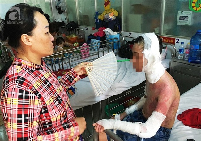 Nước mắt người mẹ bỏ việc lên Sài Gòn chăm con bị bỏng cồn nặng: Tôi sắp bị công ty cắt hợp đồng - Ảnh 2.