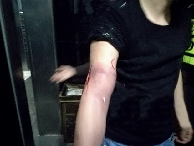 co vot iphone 8 roi vao bon cau, chang trai suyt mat ca canh tay hinh anh 2