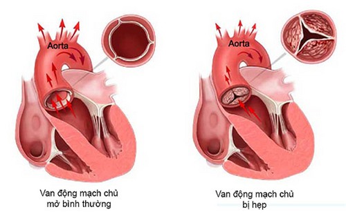 SHOCK: Hậu vệ Văn Thanh từng mắc bệnh nguy hiểm tính mạng, phải chạy chữa suốt 3 năm-4