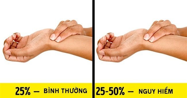 Chuyên gia hướng dẫn 5 bài kiểm tra sức khỏe bạn có thể làm nhanh tại nhà-1