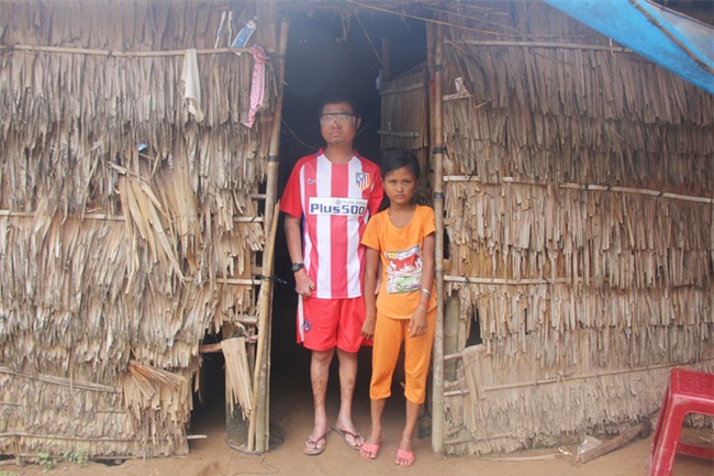 Bố mất chưa giỗ đầu thì mẹ qua đời, em gái 10 tuổi đau đớn nhìn anh trai mắc bệnh hiểm nghèo mà không có tiền chữa - Ảnh 2.