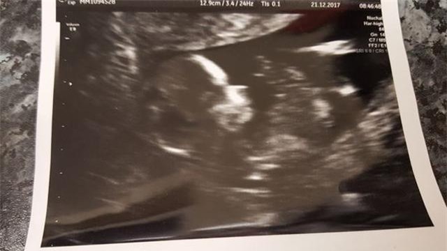 dau don khi con chet luu o tuan 19, nguoi me van co giu vi ly do rat dau long - 2