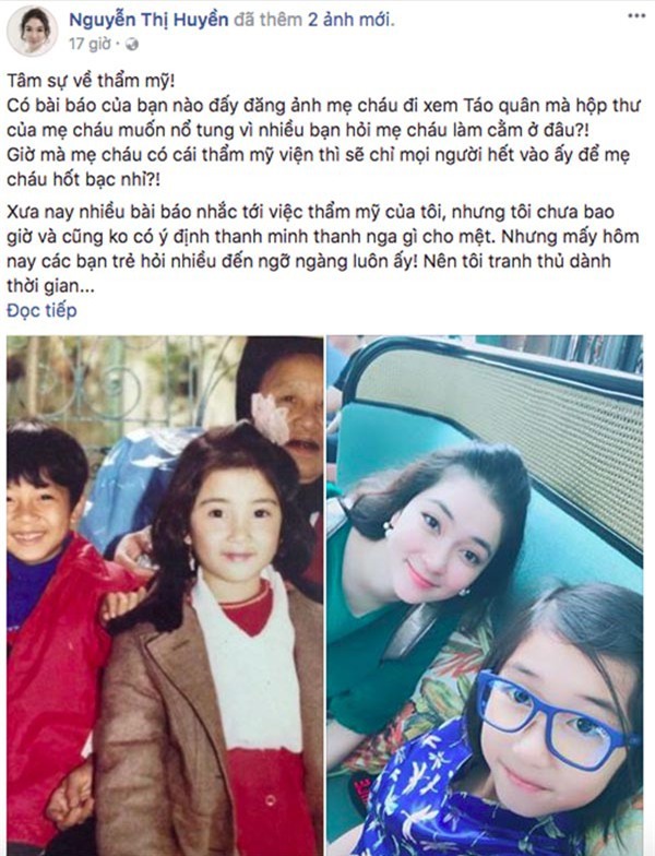 Hoa hậu Nguyễn Thị Huyền viết tâm thư đáp trả chuyện dao kéo
