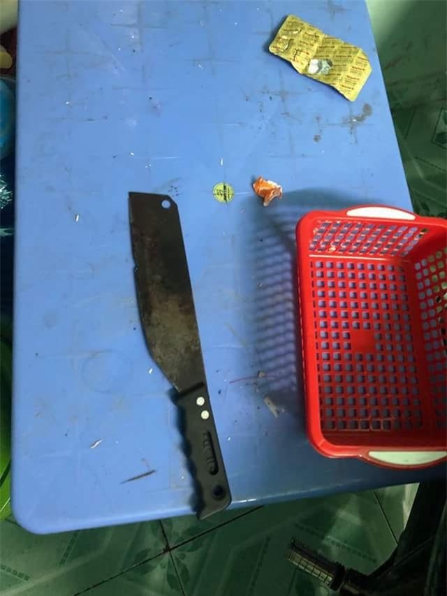 Chồng cầm dao chém vào mặt vợ nghi do ghen tuông - Ảnh 3.