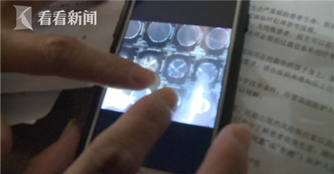 thai phu vua nam xuong da sinh, bac si do cham khien em be roi xuong chan thuong nghiem trong - 2