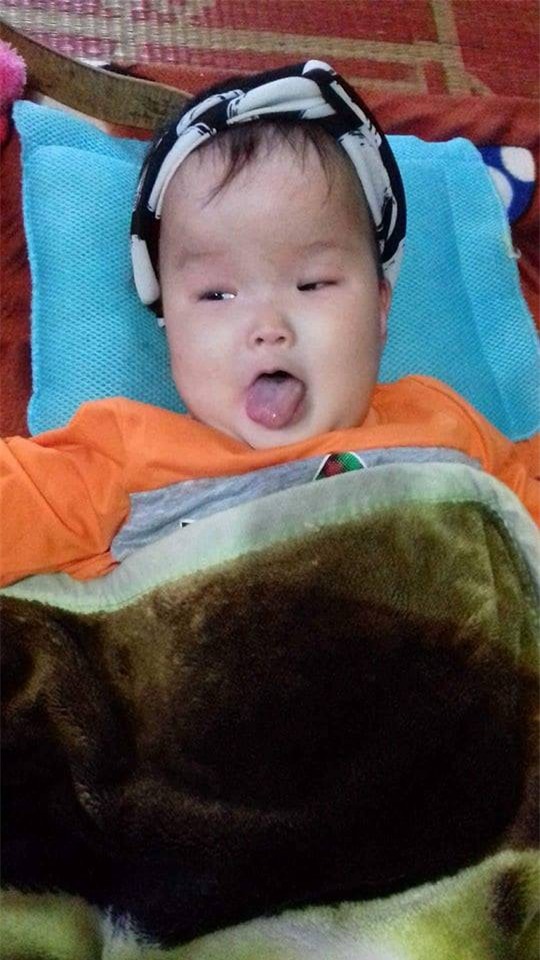 Tâm sự nghẹn lòng của mẹ 9x có con bị não úng thủy: Sợ một ngày con sẽ rời xa mẹ - Ảnh 3.