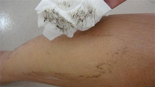 tuong tan cac buoc triet long vinh vien tai nha voi oxy gia ai ai cung lam duoc! - 3