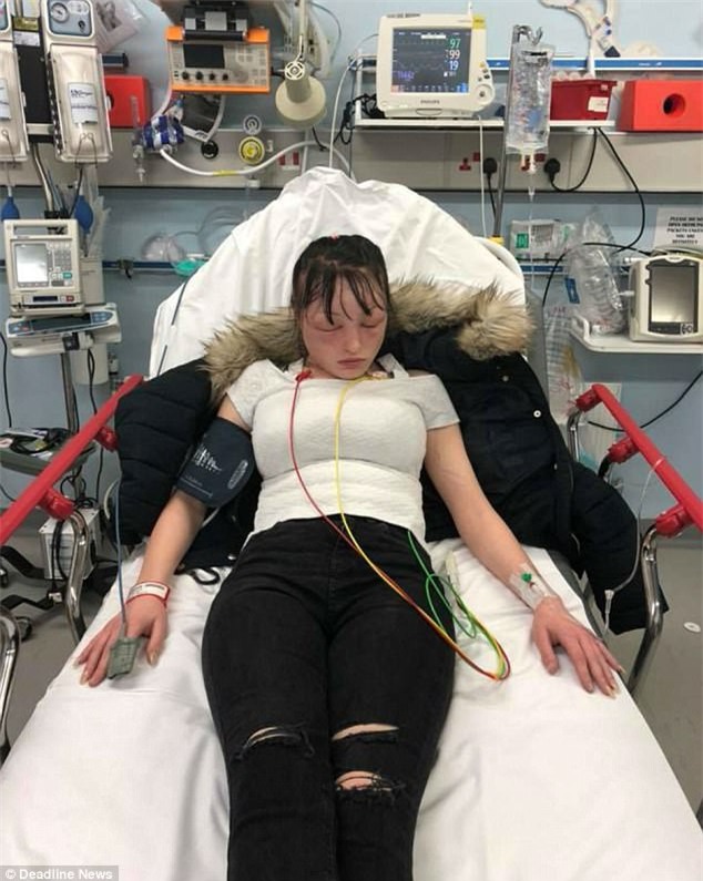 Tự mình nhuộm tóc ở nhà, người phụ nữ “tá hoả phát hiện gương mặt biến dạng, thậm chí không thể mở mắt - Ảnh 2.