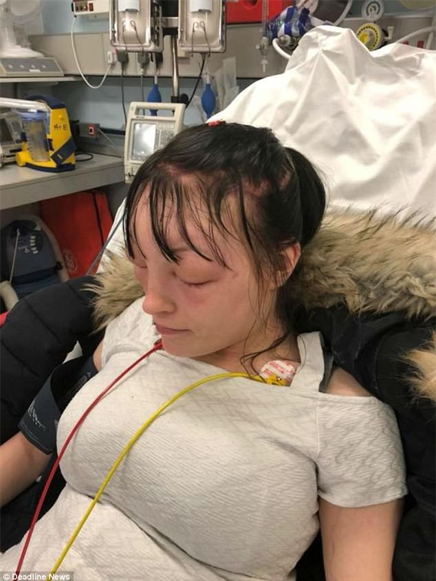 Tự mình nhuộm tóc ở nhà, người phụ nữ “tá hoả phát hiện gương mặt biến dạng, thậm chí không thể mở mắt - Ảnh 3.