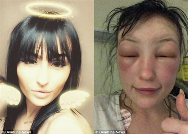 Tự mình nhuộm tóc ở nhà, người phụ nữ “tá hoả phát hiện gương mặt biến dạng, thậm chí không thể mở mắt - Ảnh 4.