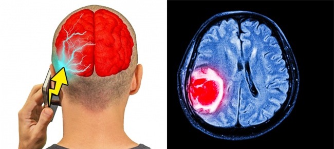 Điện thoại di động,Smartphone,Sức khỏe,Ung thư