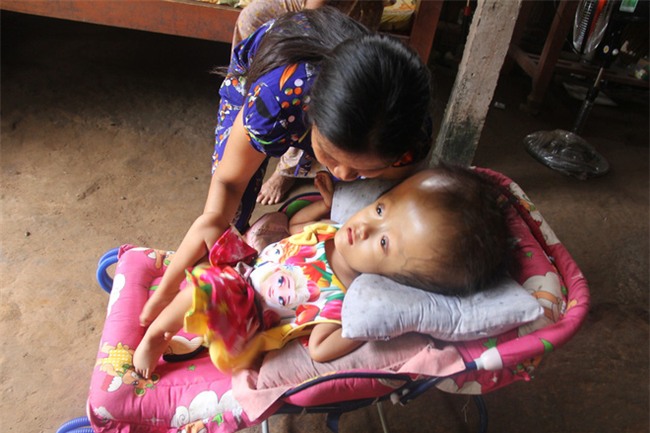 Phép màu kỳ diệu đến với cặp vợ chồng trẻ nuôi con gái 4 tuổi bị não úng thủy, đầu to gấp 3 lần trong năm mới - Ảnh 11.