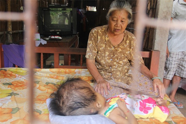 Phép màu kỳ diệu đến với cặp vợ chồng trẻ nuôi con gái 4 tuổi bị não úng thủy, đầu to gấp 3 lần trong năm mới - Ảnh 5.